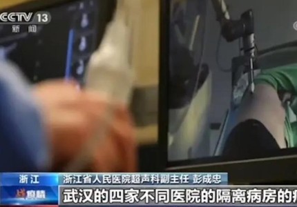央视报道华大智造远程超声机器人：随调随用，驰援疫区多家医院救治新冠肺炎患者